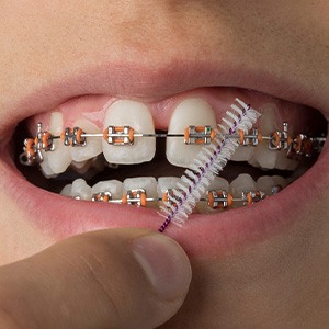 Taking care of your smile can save you money on emergency costs