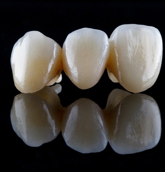 Close-up of a dental bridge in Denison, IA on a black reflective surface