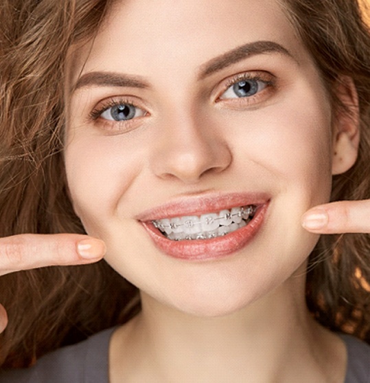 woman with curly hair showing off ceramic braces