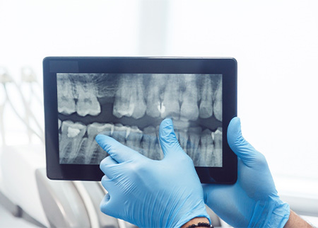 Woman receiving dental checkup