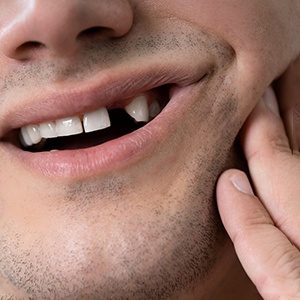 man smiling with missing tooth 