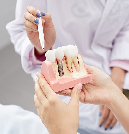 Dentist showing patient a dental implant model