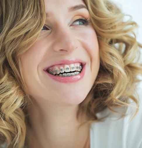 Lady smiles with braces?