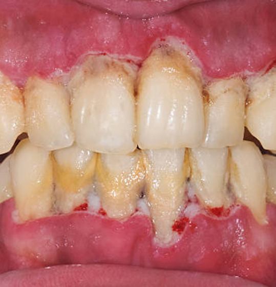 Smiling female patient looking in dental mirror