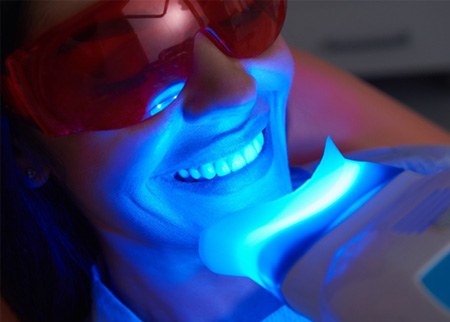 A woman receiving a teeth whitening treatment