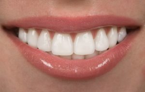 a close-up of a beautiful smile from cosmetic dentistry