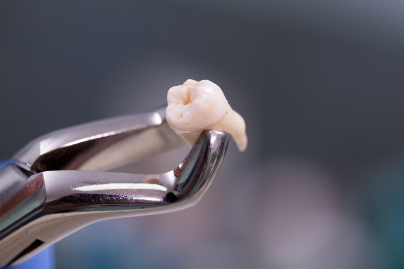 A tooth that needed extraction